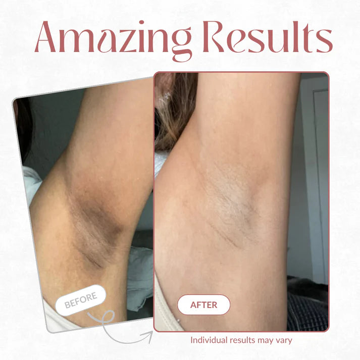 Spray Away Bumps, Spots & Dullness