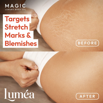 Luméa ® Magic Body Oil - 100ml