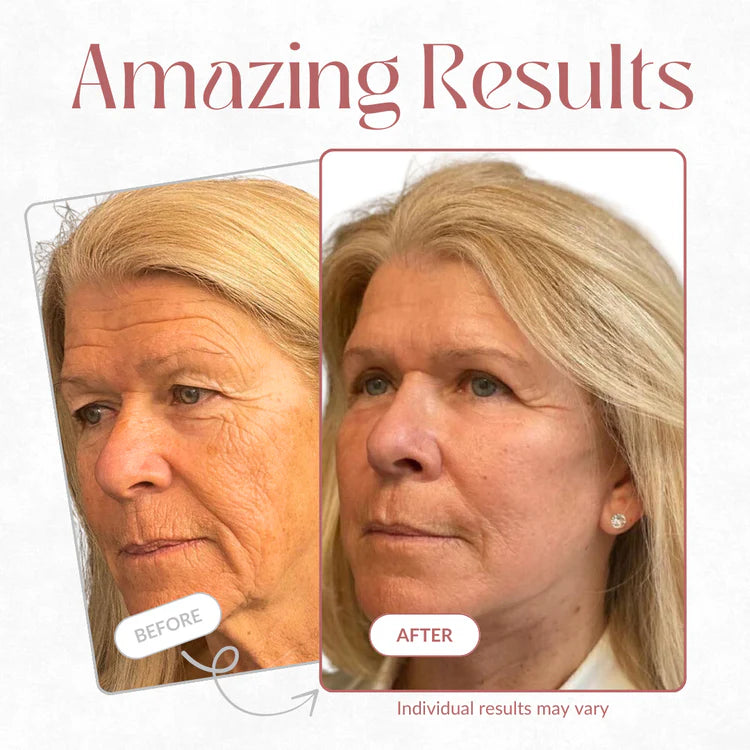 Swipe Away Wrinkles, Refill Hollow Under-Eyes